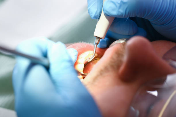 Best Urgent Tooth Repair  in Gloucester City, NJ